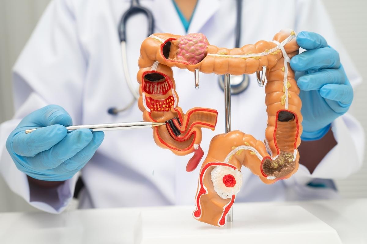 Gastroenterólogo en Tehuacán, Puebla